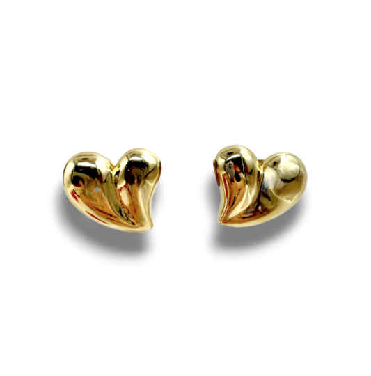 ARETES ILEAN
